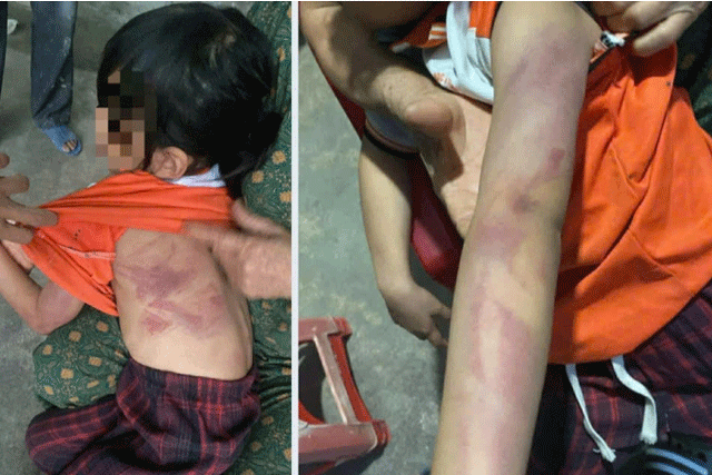 Be-gai-lop-2-bi-ban-nam-cung-lop-danh-1