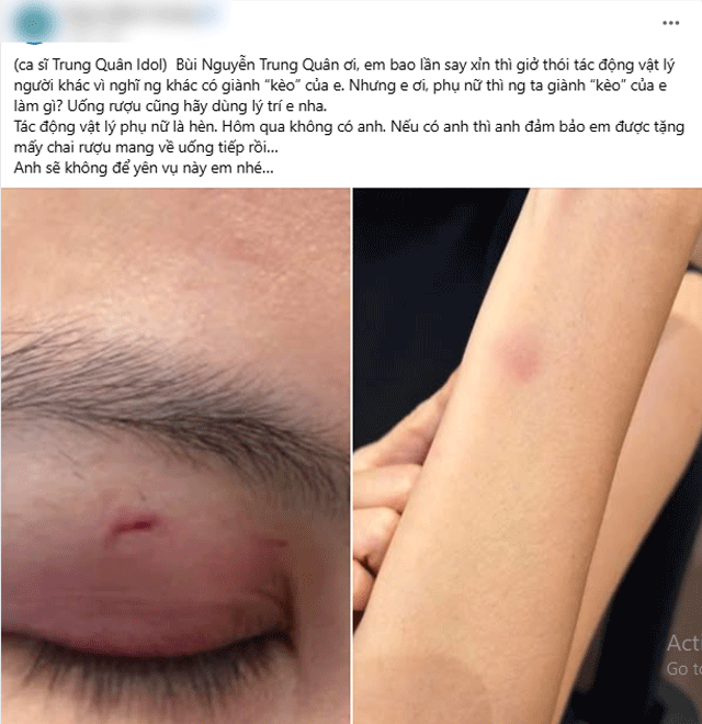 Ca-si-trung-quan-idol-4