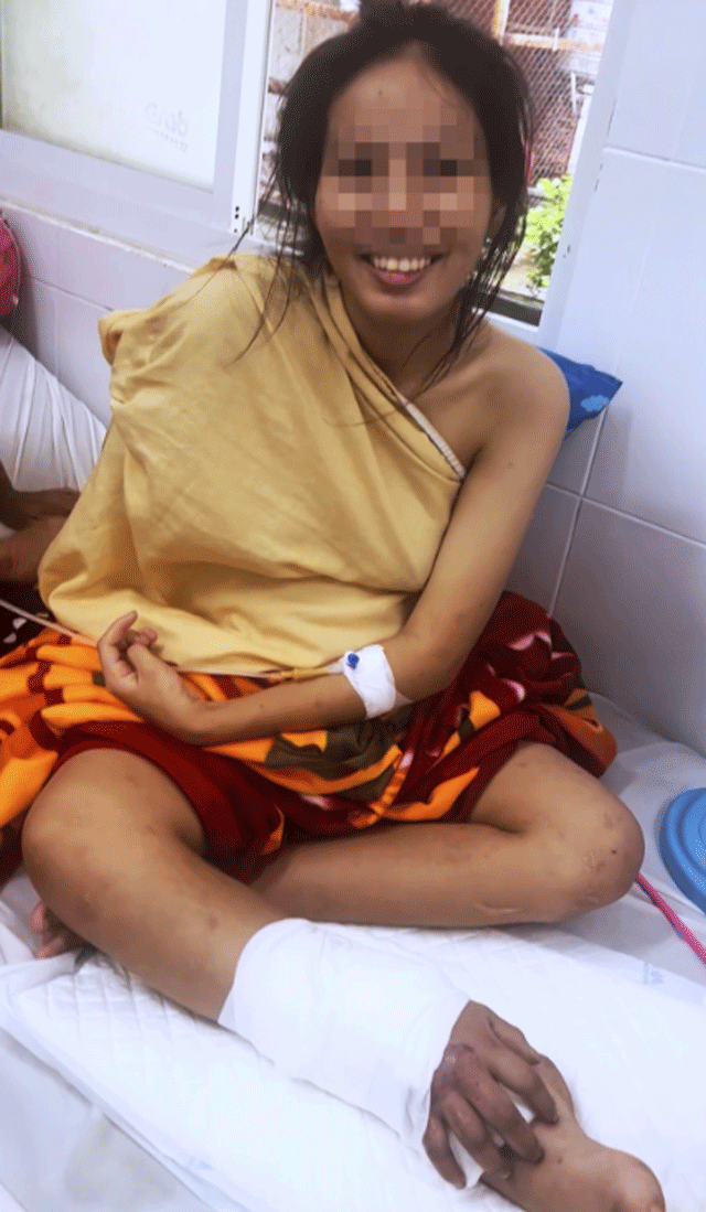 Tinh-hinh-suc-khoe-song-thai-vu-co-gai-duoc-ghep-tam-tay-dut-lia-vao-chan-he-lo-hoan-canh-xot-xa-5