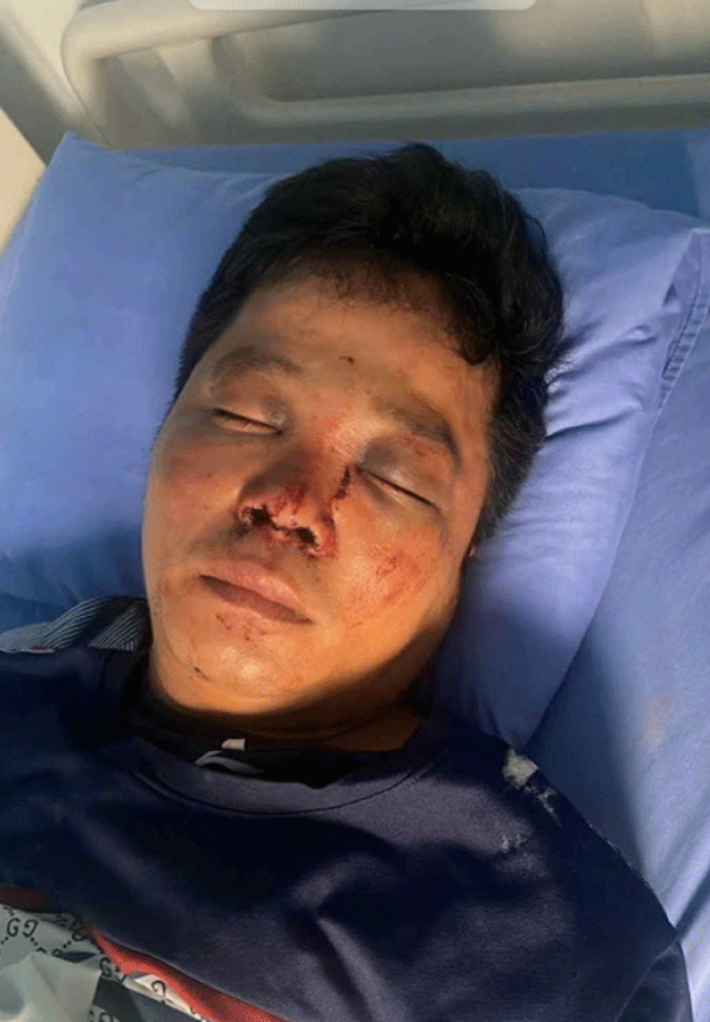 Ho-tro-nguoi-gap-tai-nan-giao-thong-2-anh-em-o-bac-ninh-bi-nguoi-nha-nan-nhan-danh-den-nguy-kich-2
