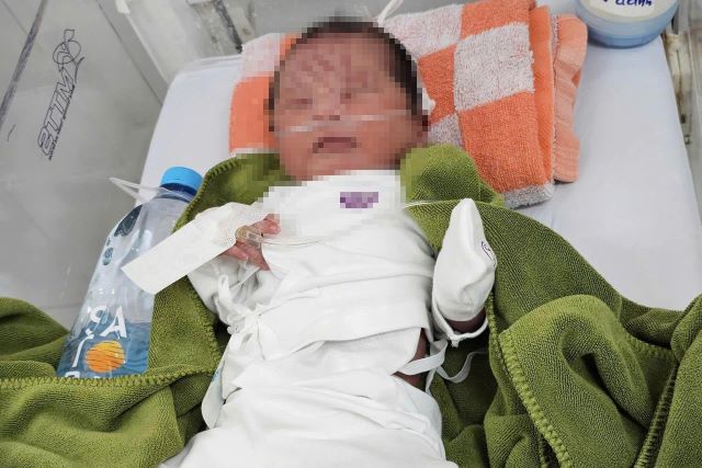 be-gai-bi-chon-song-vuon-cao-su