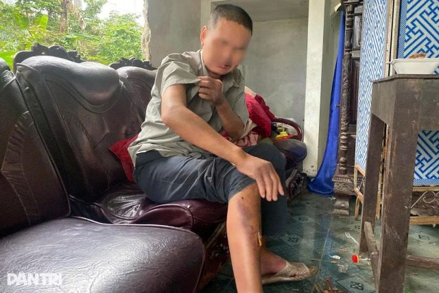 nguoi-dan-ng-bi-nhom-hoc-sinh-bao-luc-o-hue