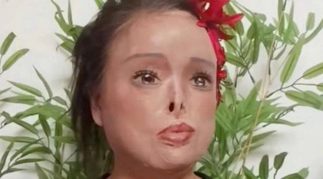 nguoi-phu-nu-bi-chong-tat-axit-tu-ve-khuon-mat-doi-doi-1