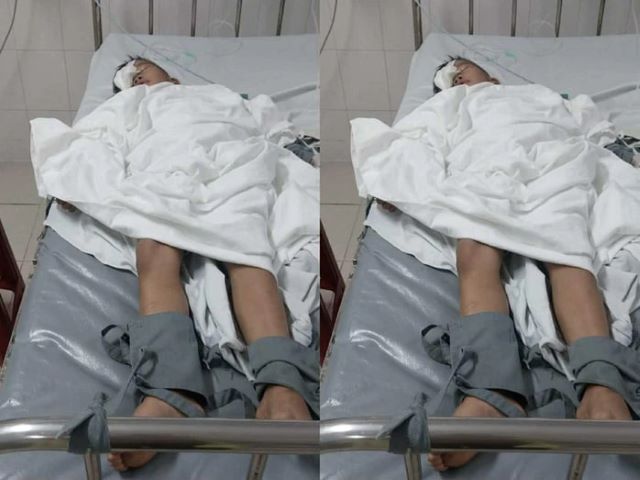 phu-huynh-to-ban-hoc-danh-con-lop-1-bi-ton-thuong-mat