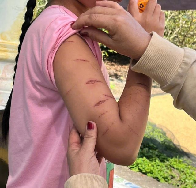 nu-sinh-bi-chi-ho-rach-tay