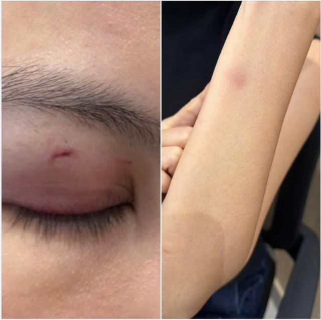 trung-quan-idol-bi-to