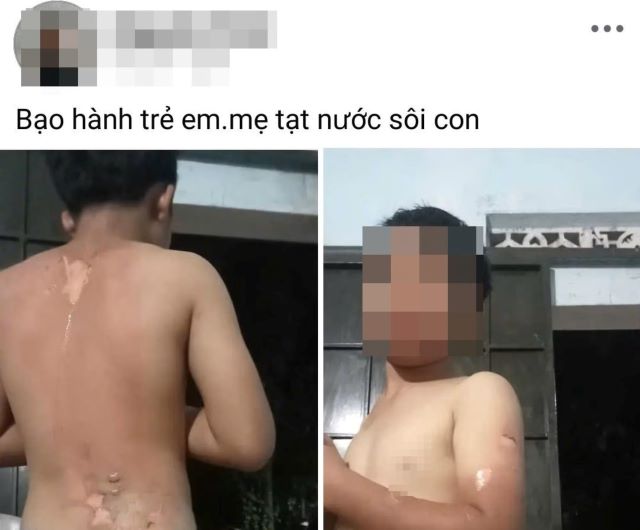 be-trai-nghi-bi-me-tat-nuoc-soi-len-nguoi-dak-lak