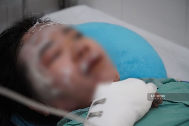 nan-nhan-vu-chay-xe-khach-dong-nai-ke-lai-chi-tiet-bat-thuong-3
