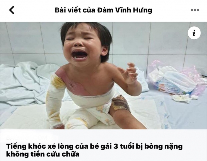 Mr-dam-keu-goi-khan-gia-giup-do-be-gai-3-tuoi-bi-bong-nang-con-quan-quai-gao-khoc-roi-ngat-lim