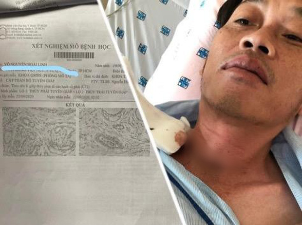 Gd-benh-vien-cho-ray-xac-nhan-hoai-linh-van-phai-dieu-tri-thuong-xuyen-can-benh-ung-thu-tuyen-giap