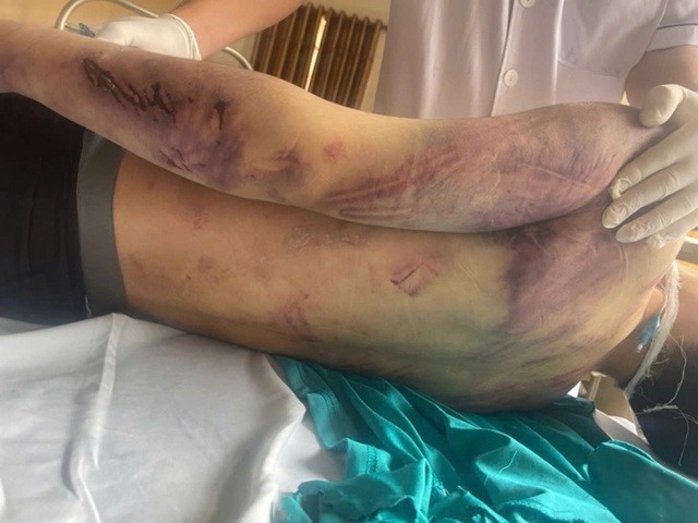 danh-hoc-vien-1-17667400588582146778328_11zon