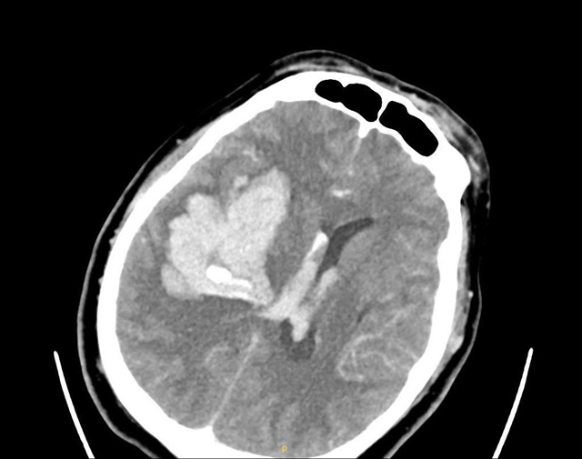 584327941-122230370738141327-7120446437881213138-n-799