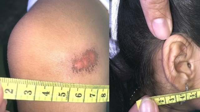 be-6-tuoi-bi-bao-hanh-3