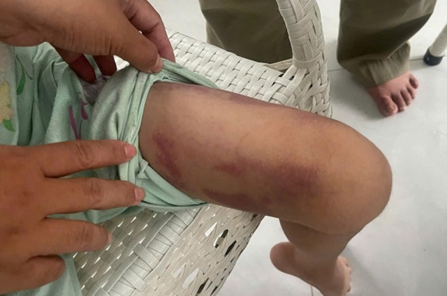 me-va-nguoi-tinh-bao-hanh-chau-be-9-tuoi-1