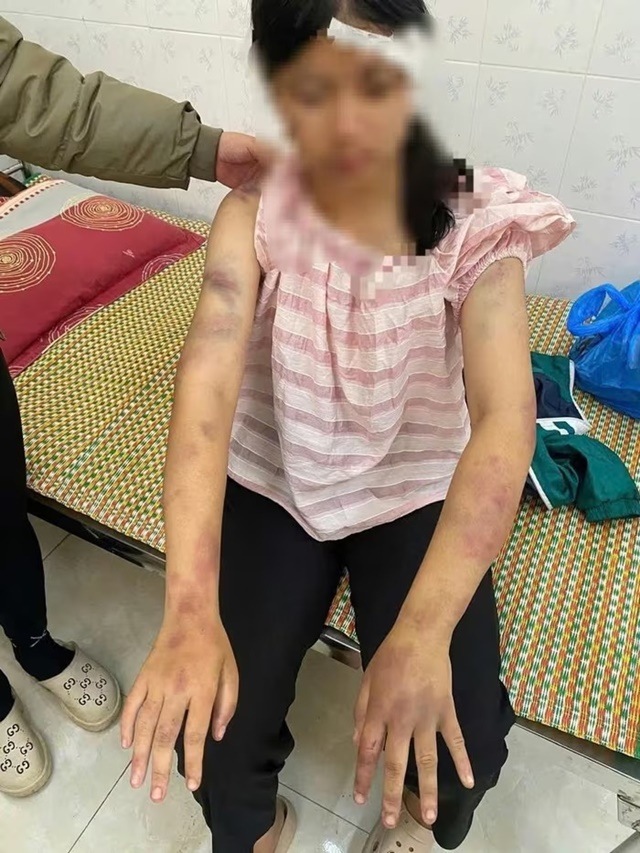 be-gai-13-tuoi-bi-danh-dap-1