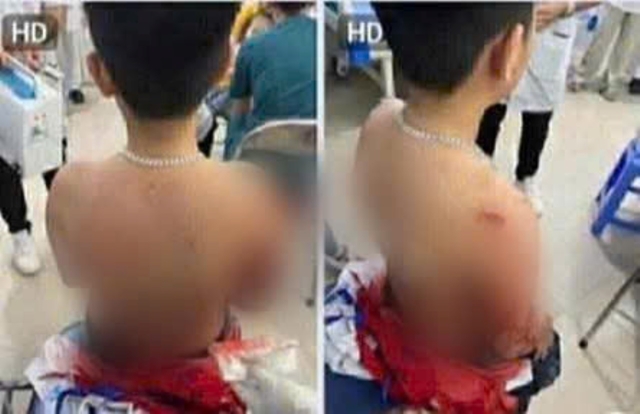 nam-sinh-lop-8-hat-ban-xuong-ho-3