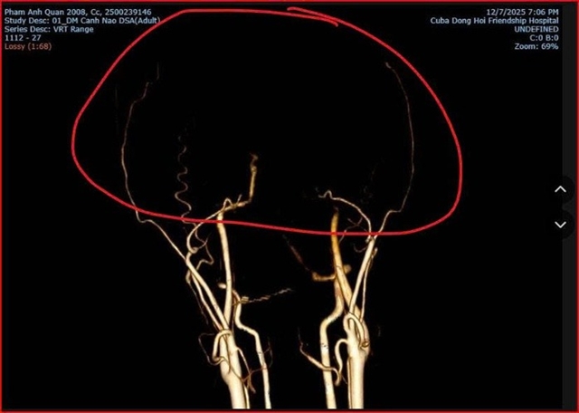 danh-nhau-trong-quan-bida-1