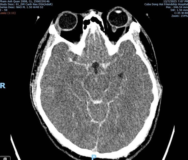 danh-nhau-trong-quan-bida-2