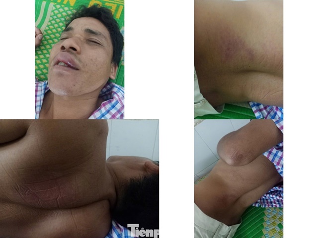 bi-danh-than-tan-ma-dai-1