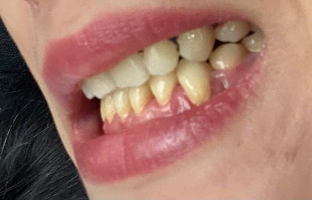 bac-si-nha-khoa-danh-nguoi-3