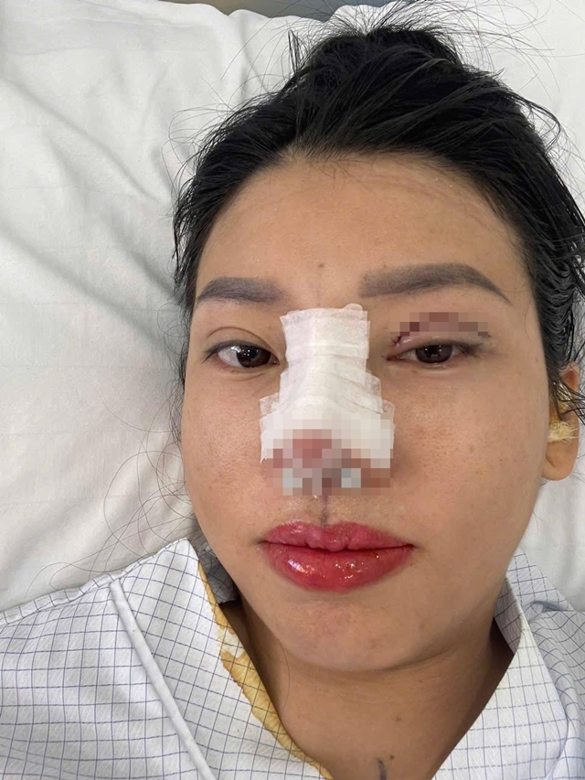 thi-no-quach-phuong-1