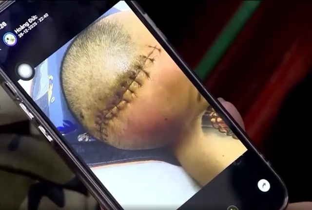 trung-tam-cong-tac-xa-hoi-hai-ha-4 (1)