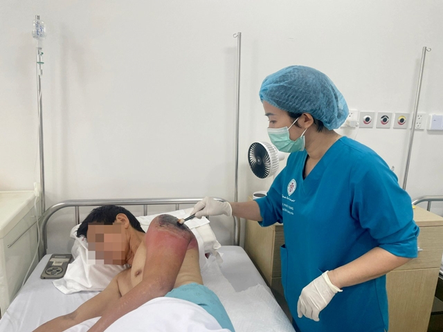 dap-la-chua-chan-thuong-1