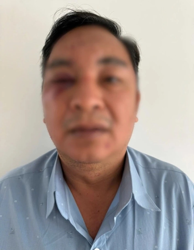 danh-nhau-dong-nai-1