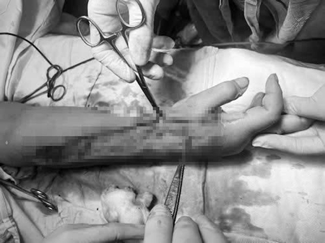 624738288-122268723392034558-319