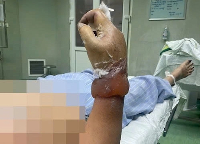 625366668-122268723338034558-560