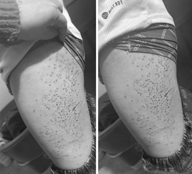 mau-a1-edited-1773293878982