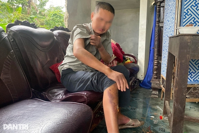 nguoi-dan-ong-bi-nhom-hoc-sinh-hanh-ha-3