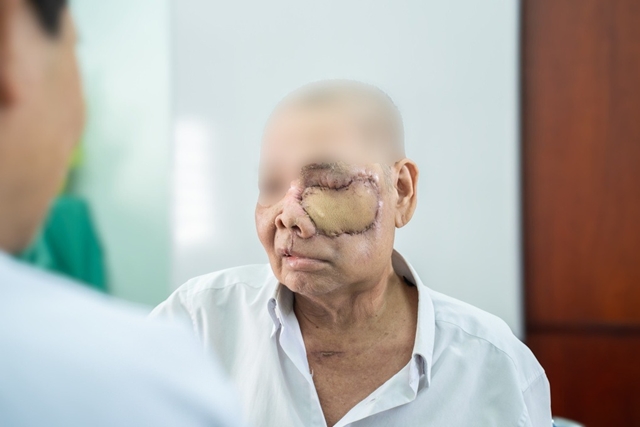 ung-thu-hoc-muijpg-1772633795920