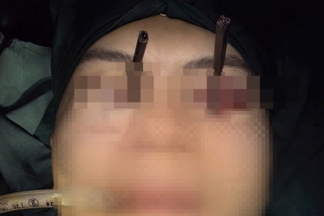 ED_dua_dam_vao_mat_1