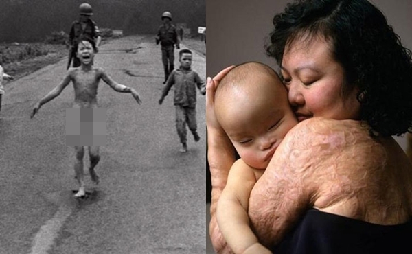 “Em bé napalm” trong bức ảnh quyền lực nhất thế giới giờ ra sao?