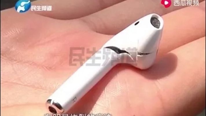 AirPods phát nổ trong khi đang gọi điện thoại khiến người dùng phải nhập viện