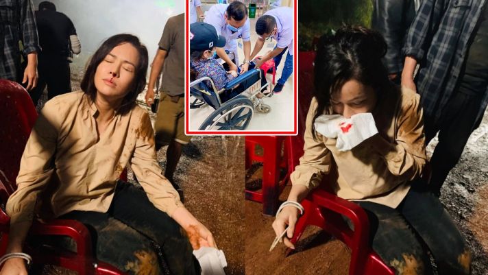 Vừa bị tai nạn, Nhật Kim Anh gây hoang mang với hình ảnh ‘đổ máu’ trên phim trường, khiến CĐM xót xa
