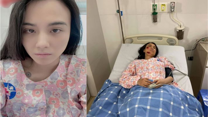Linh Miu chính thức lên tiếng sau khi CĐM gửi lời chúc mừng khi thấy ảnh cô chấn thương nằm viện