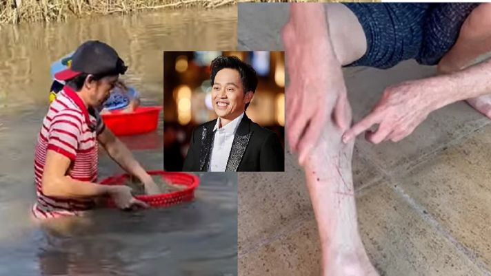 Clip Hoài Linh lội nước,dầm mình bắt cá ở tuổi 52, lộ chân bầm tím đầy vết cắt khiến khán giả xót xa