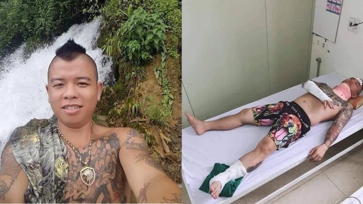 ‘Thánh chửi’ Dương Minh Tuyền nói rõ chuyện bị đánh nhập viện, cơ quan chức năng cũng lên tiếng