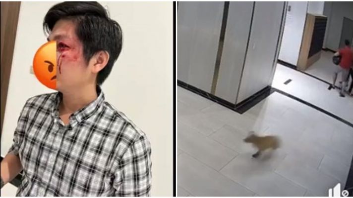 Xôn xao clip người đàn ông bị tác động vật lý đến gãy răng khi bảo vệ trẻ em khỏi chó tại chung cư