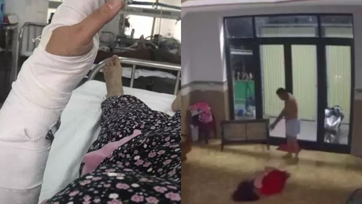 Đà Nẵng: Phẫn nộ chồng đánh vợ đến nhập viện, thấy bất tỉnh vẫn thản nhiên bấm điện thoại