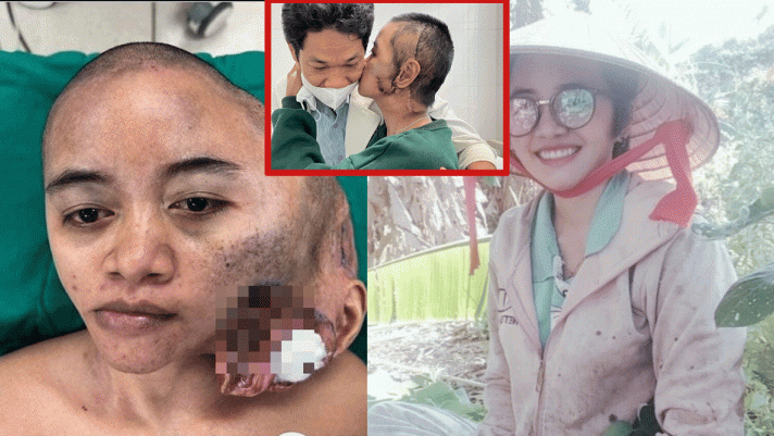 Cú lột xác ngoạn mục về diện mạo của cô gái 31 tuổi có khối u khổng lồ trên đầu ở Ninh Thuận