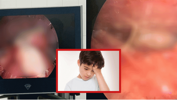 Hải Phòng: Bé trai 8 tuổi vỡ ruột thừa sau 3 ngày bị đau bụng quằn quại do gia đình mải đi du lịch
