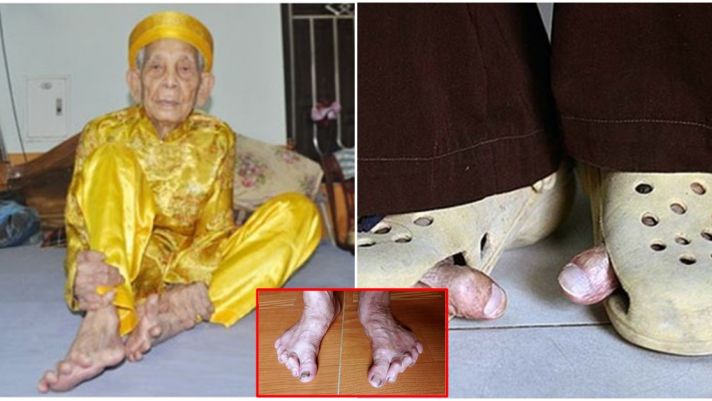Bí mật bất ngờ về ‘bàn chân Giao chỉ’ của người Việt cổ:Cả nước chỉ còn rất ít người có đặc điểm này