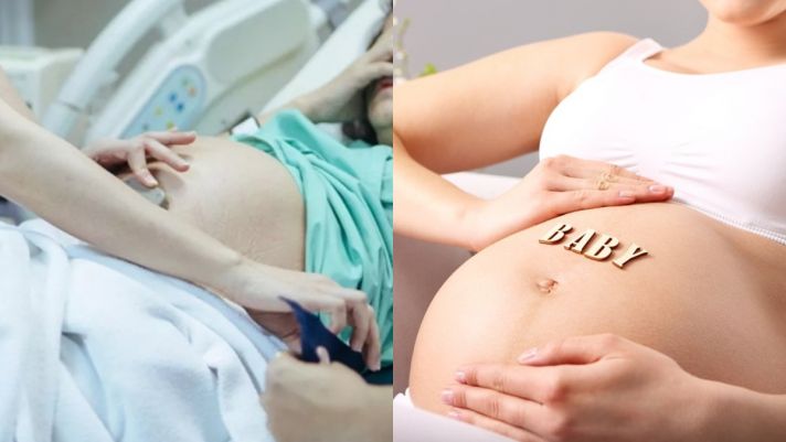 Chuyện siêu hiếm trên thế giới: Em bé chào đời sống sót sau 29 tuần lớn lên trong khoang bụng mẹ