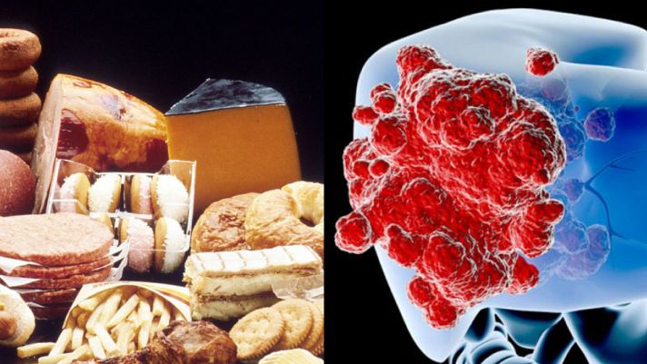 2 món ăn ngon miệng nhưng lại có hại vô cùng cho sức khỏe của bạn, dễ mắc bệnh tiểu đường