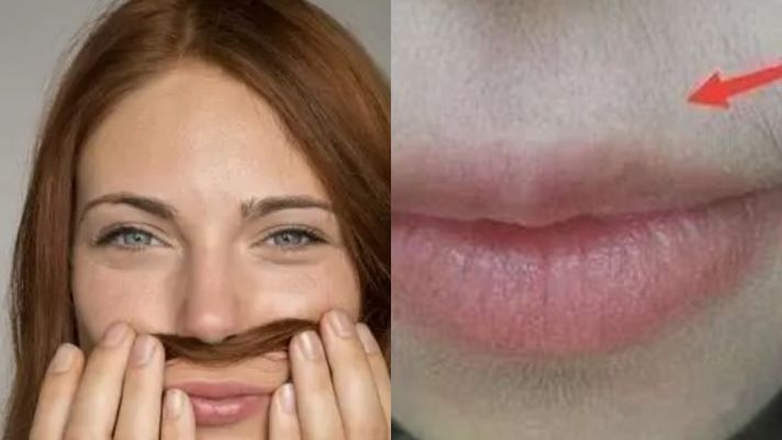 Phụ nữ có nên cạo ‘râu’ không? Phải hiểu được 3 điều này để bảo vệ sức khỏe!