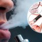 Hút thuốc lá điện tử có khả năng làm tăng nguy cơ lây nhiễm Covid-19