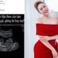 Phi Thanh Vân đăng hình siêu âm khi đang làm mẹ đơn thân: 'Con trai nữa rồi', khiến CĐM ngỡ ngàng